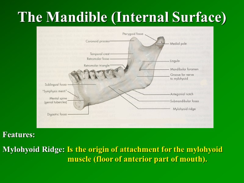 The Mandible (Internal Surface)   Features: Mylohyoid Ridge: Is the origin of attachment